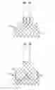 Fig. 04 - Repositioning of prosthetic heart valve and deployment