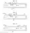 Fig. 17 - Repositioning of prosthetic heart valve and deployment