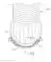 Fig. 01 - Methods of assembling a valved aortic conduit