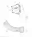 Fig. 02 - Methods of assembling a valved aortic conduit