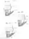 Fig. 09 - Methods of assembling a valved aortic conduit