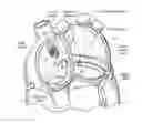 Fig. 01 - DEVICES, SYSTEMS, AND METHODS FOR RESHAPING A HEART VALVE ANNULUS INCLUDING THE USE OF MAGNETIC TOOLS
