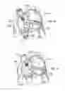 Fig. 09 - DEVICES, SYSTEMS, AND METHODS FOR RESHAPING A HEART VALVE ANNULUS INCLUDING THE USE OF MAGNETIC TOOLS