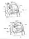 Fig. 11 - DEVICES, SYSTEMS, AND METHODS FOR RESHAPING A HEART VALVE ANNULUS INCLUDING THE USE OF MAGNETIC TOOLS