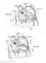 Fig. 13 - DEVICES, SYSTEMS, AND METHODS FOR RESHAPING A HEART VALVE ANNULUS INCLUDING THE USE OF MAGNETIC TOOLS