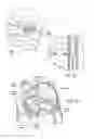 Fig. 16 - DEVICES, SYSTEMS, AND METHODS FOR RESHAPING A HEART VALVE ANNULUS INCLUDING THE USE OF MAGNETIC TOOLS