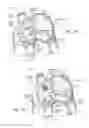 Fig. 17 - DEVICES, SYSTEMS, AND METHODS FOR RESHAPING A HEART VALVE ANNULUS INCLUDING THE USE OF MAGNETIC TOOLS