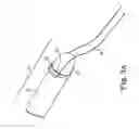 Fig. 07 - Resorbable suture-engagement component for a penile prosthetic