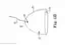Fig. 13 - Resorbable suture-engagement component for a penile prosthetic