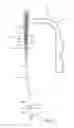 Fig. 02 - Composite material bone implant