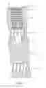 Fig. 03 - Composite material bone implant