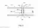 Fig. 06 - Composite material bone implant