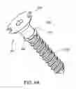 Fig. 07 - Composite material bone implant