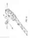 Fig. 27 - Composite material bone implant