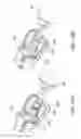 Fig. 31 - Composite material bone implant