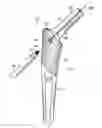 Fig. 01 - Femoral stem and post system for hip prosthesis