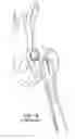 Fig. 03 - Femoral stem and post system for hip prosthesis