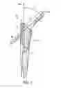 Fig. 04 - Femoral stem and post system for hip prosthesis