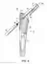 Fig. 06 - Femoral stem and post system for hip prosthesis