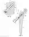 Fig. 10 - Femoral stem and post system for hip prosthesis