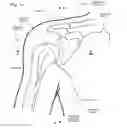 Fig. 02 - IMPLANTABLE PROSTHESES
