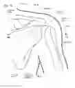 Fig. 03 - IMPLANTABLE PROSTHESES