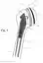 Fig. 07 - IMPLANTABLE PROSTHESES