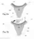 Fig. 09 - IMPLANTABLE PROSTHESES