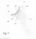 Fig. 10 - IMPLANTABLE PROSTHESES