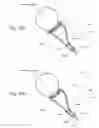 Fig. 13 - IMPLANTABLE PROSTHESES