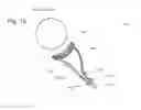 Fig. 17 - IMPLANTABLE PROSTHESES
