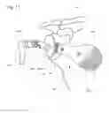 Fig. 19 - IMPLANTABLE PROSTHESES
