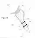 Fig. 20 - IMPLANTABLE PROSTHESES