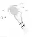 Fig. 23 - IMPLANTABLE PROSTHESES