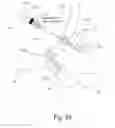 Fig. 26 - IMPLANTABLE PROSTHESES