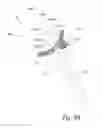 Fig. 29 - IMPLANTABLE PROSTHESES