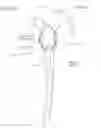 Fig. 30 - IMPLANTABLE PROSTHESES