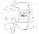 Fig. 01 - Spinal implant system and method