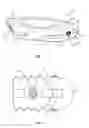 Fig. 02 - Spinal implant system and method