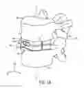 Fig. 02 - Expandable intervertebral implant