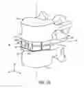 Fig. 03 - Expandable intervertebral implant