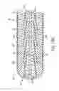 Fig. 25 - Expandable intervertebral implant