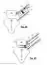 Fig. 03 - Spinal surgical implant and related methods