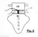 Fig. 04 - Spinal surgical implant and related methods