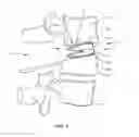 Fig. 06 - Spinal implant system and method