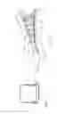 Fig. 09 - Foot prosthesis with resilient multi-axial ankle