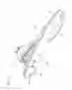 Fig. 14 - Foot prosthesis with resilient multi-axial ankle