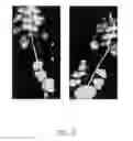 Fig. 28 - Foot prosthesis with resilient multi-axial ankle