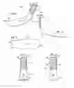 Fig. 03 - Prosthetic foot with modular construction