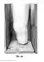 Fig. 07 - PROSTHESIS COOLING LINER SYSTEM